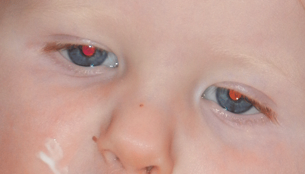 Illustration des étapes de correction des yeux rouges dans Photoshop